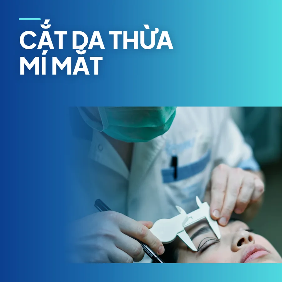 Cắt da thừa mí mắt – trẻ hóa vùng mắt