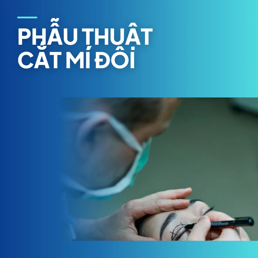 Phẫu thuật cắt mí đôi – tạo nếp mí tự nhiên