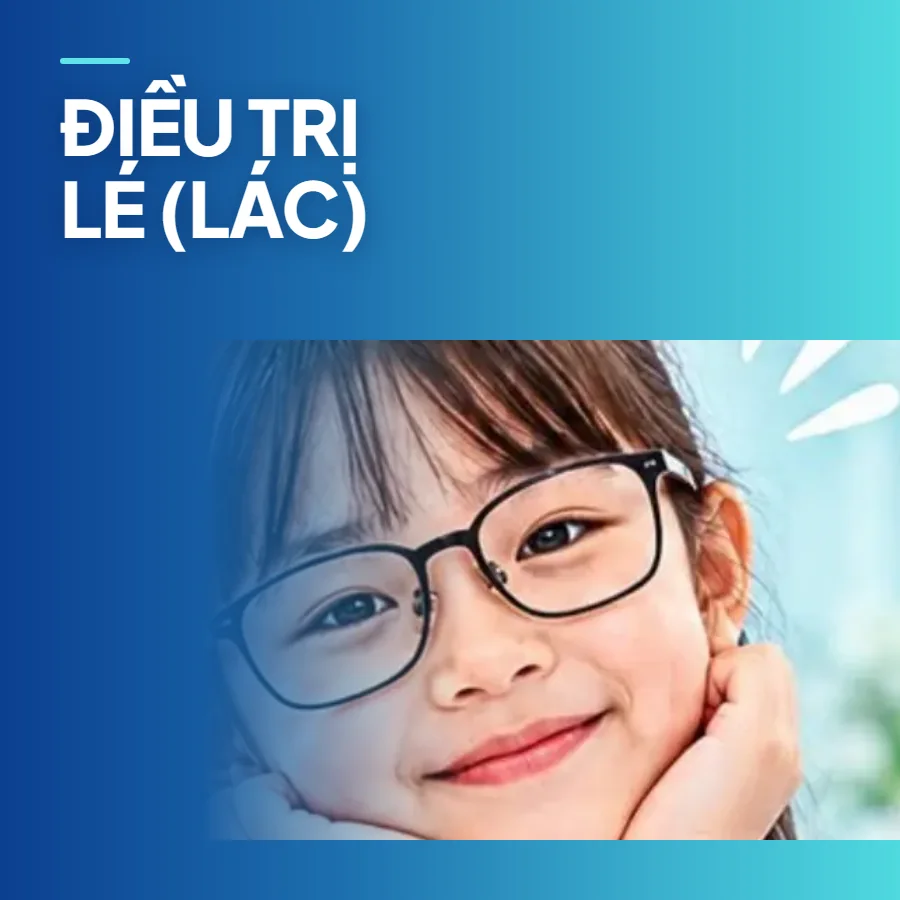 Điều trị lé (lác) ở trẻ em và người lớn