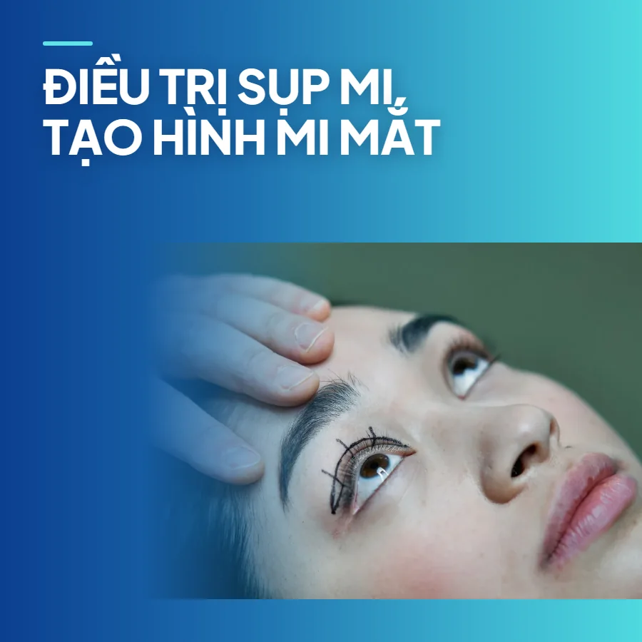 Điều trị sụp mi – tạo hình mi mắt