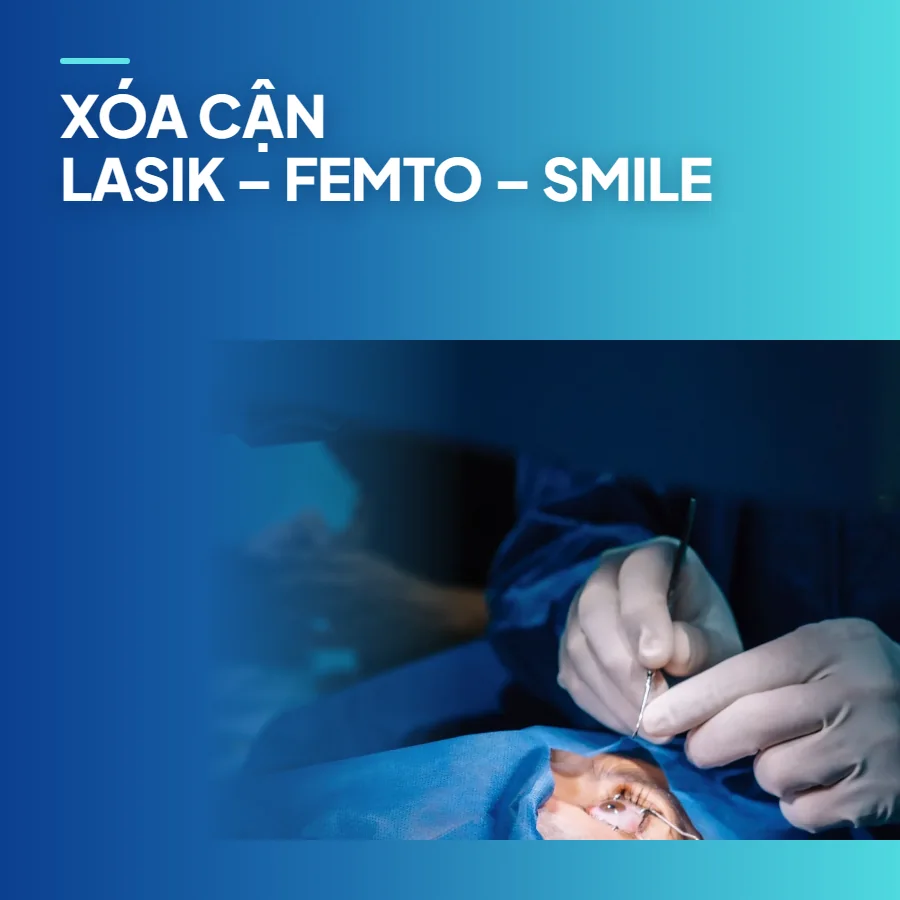 Xóa cận – so sánh các phương pháp Lasik, Femto Lasik, SMILE, PRK
